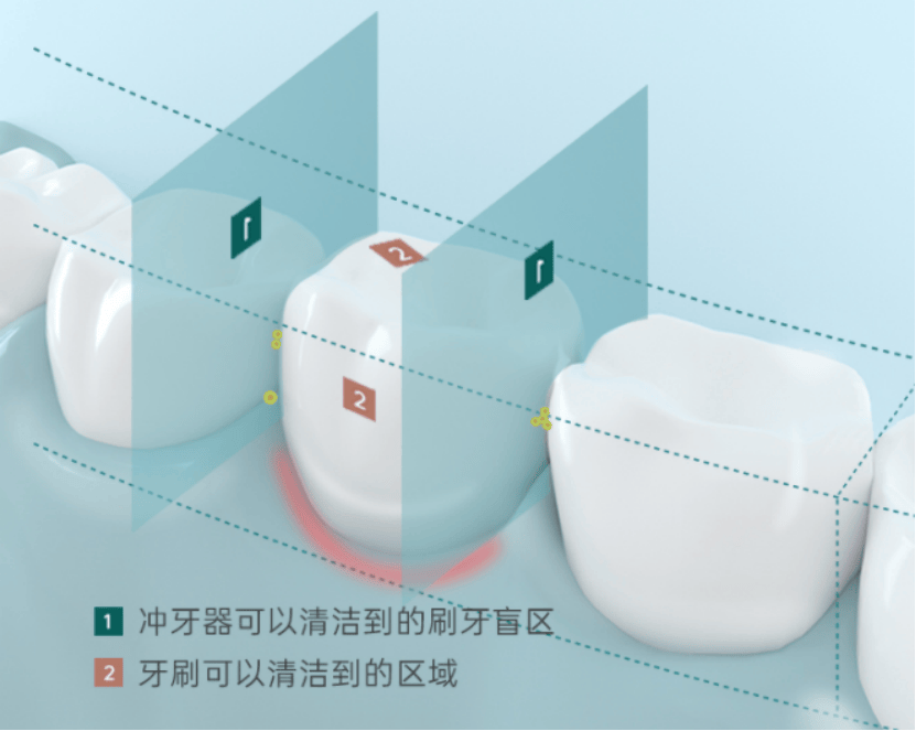 冲牙器危险吗?警惕三大风险危害!